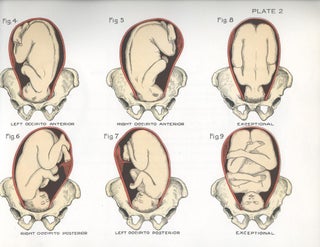 Obstetrical Charts in Color.