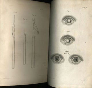 Practical Observations on the Formation of an Artificial Pupil, in Several Deranged States of the Eye; to which are annexed, Remarks on the Extraction of Soft Cataracts, and Those of the Membraneous Kind, through a Puncture in the Cornea.