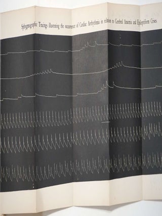 Cardiac Arrhythmia in Relation to Cerebral Anaemia and Epileptiform Crises.